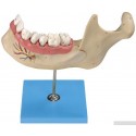 ANAT-MAGNIFIED MODEL OF MANENT TEETH & MOLAR TEETH